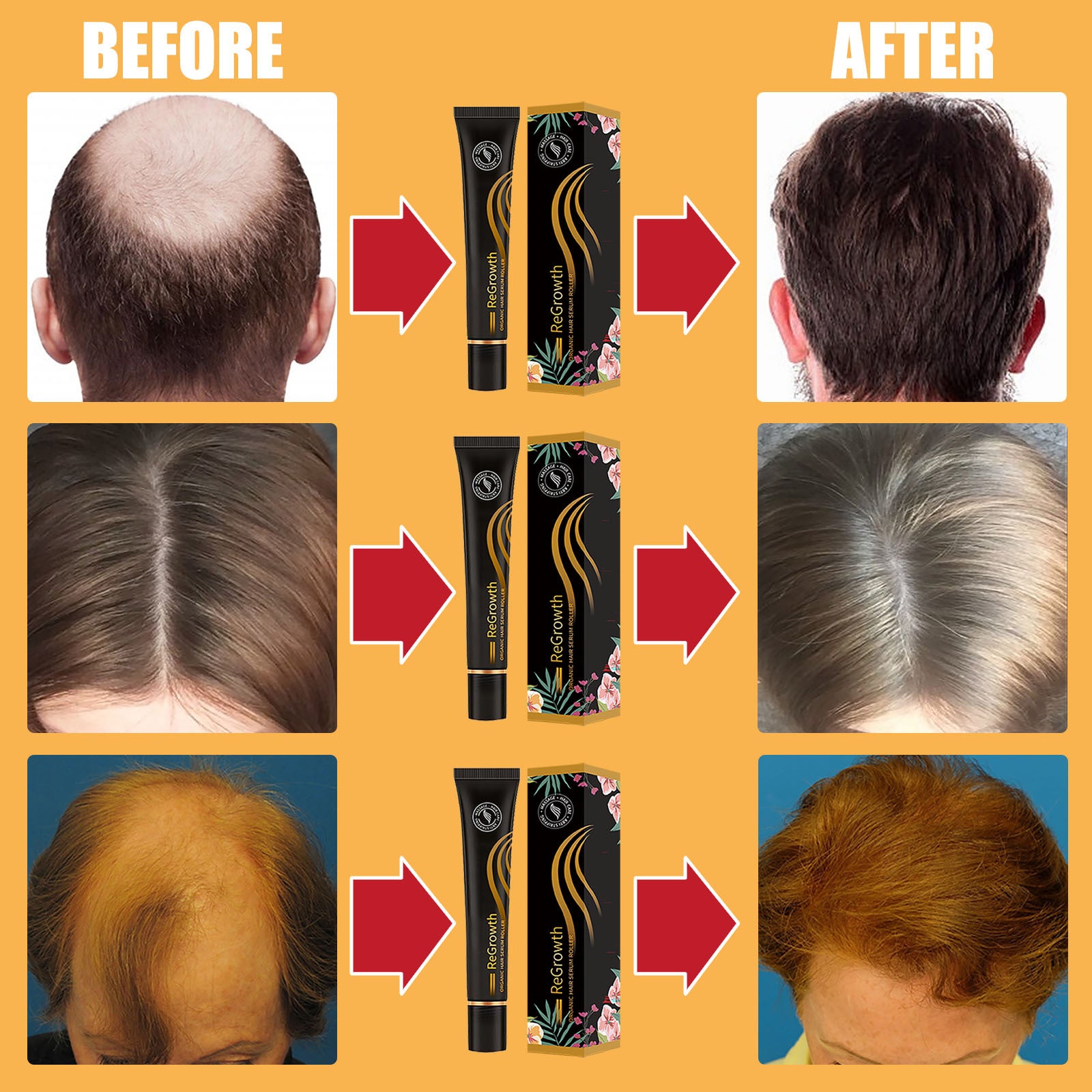 Regrowth Organic Hair Serum Roller Set Hair Care Anti Stripping Liquid Suitable For All Types Of Hair Loss Scalp Nourishing