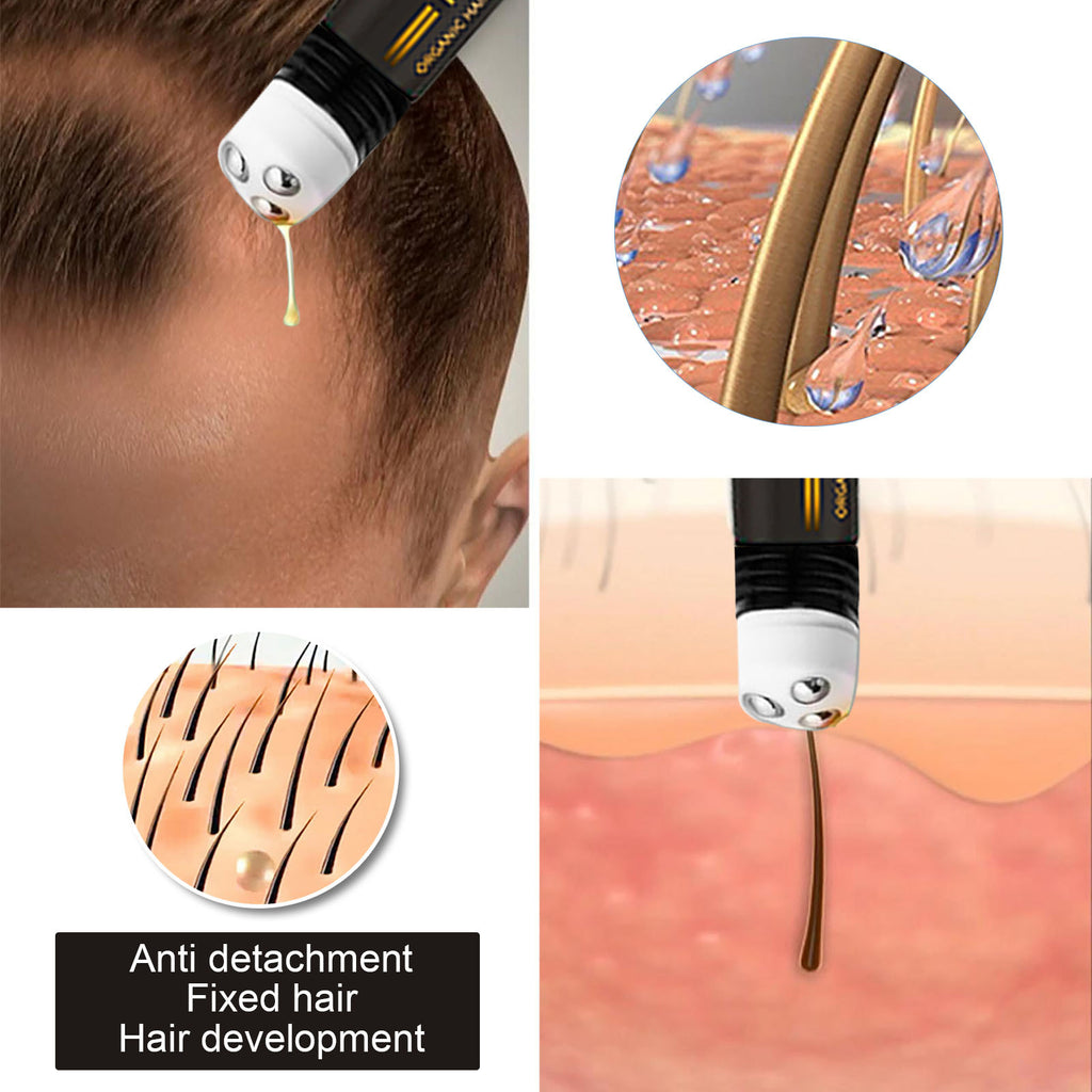 Regrowth Organic Hair Serum Roller Set Hair Care Anti Stripping Liquid Suitable For All Types Of Hair Loss Scalp Nourishing