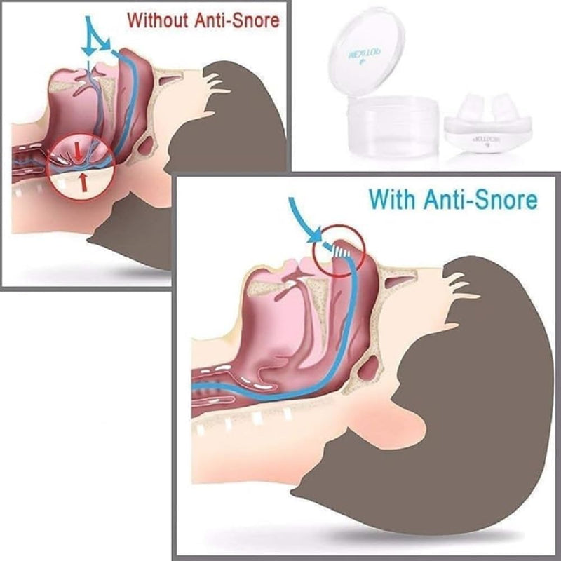SleepFlow Nasal Breathing Aid
